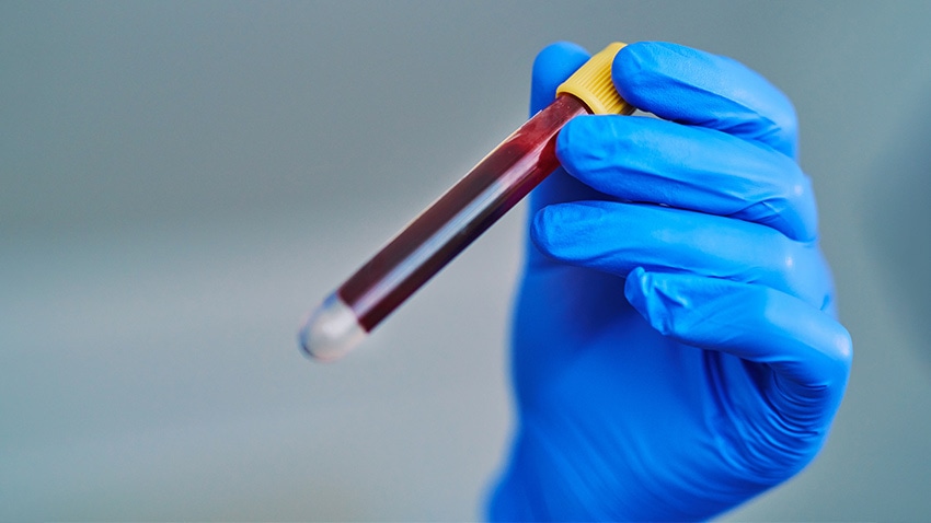 blue gloved hand holds vial of blood