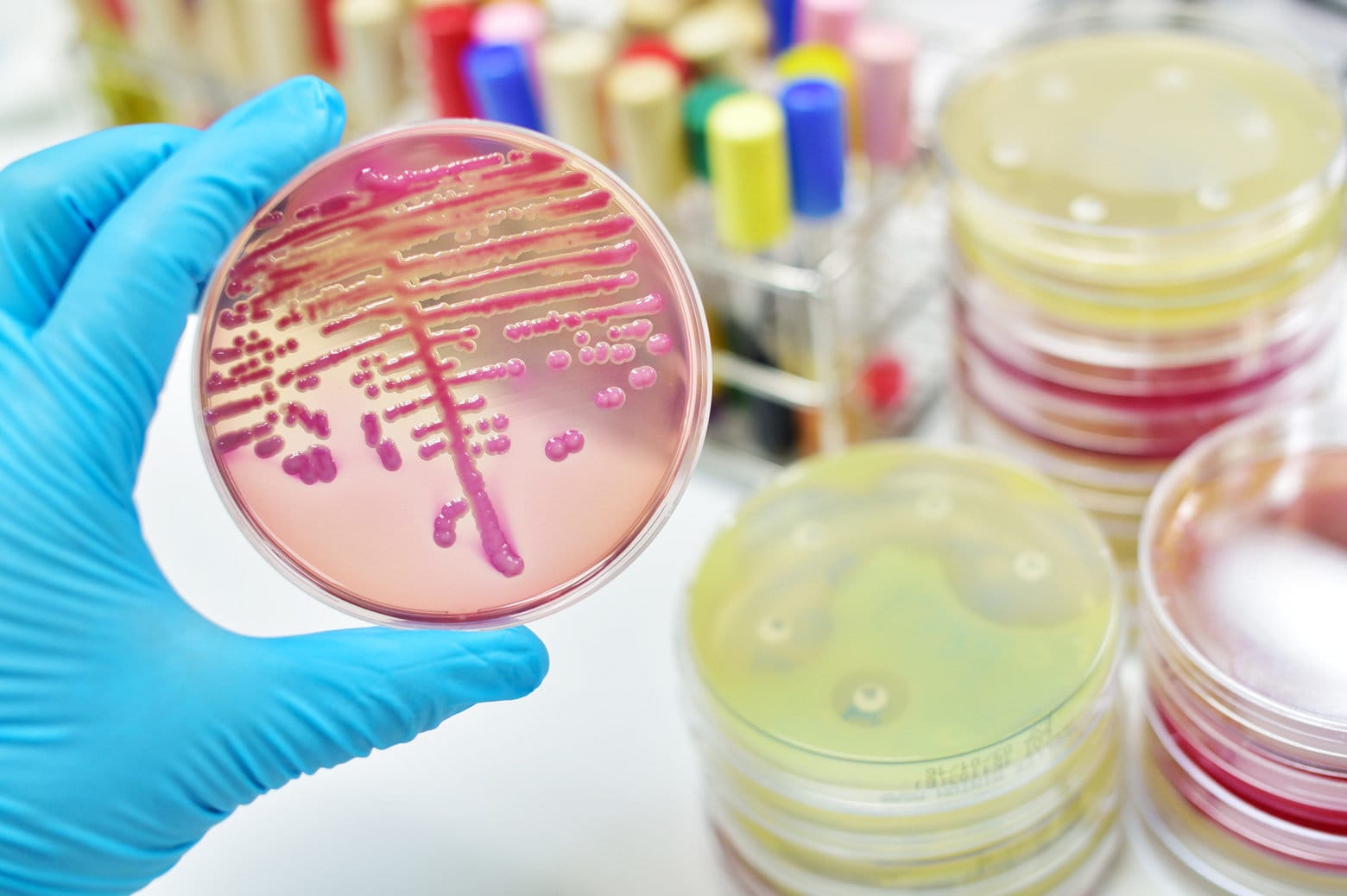 Bright pink cells in a Petri dish